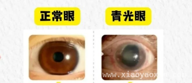 睡前玩手机危害多，这些要点要记牢！