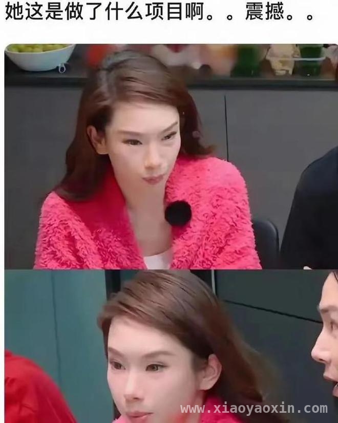 Lucky成长模样大变，戚薇直爽面对医美质疑！