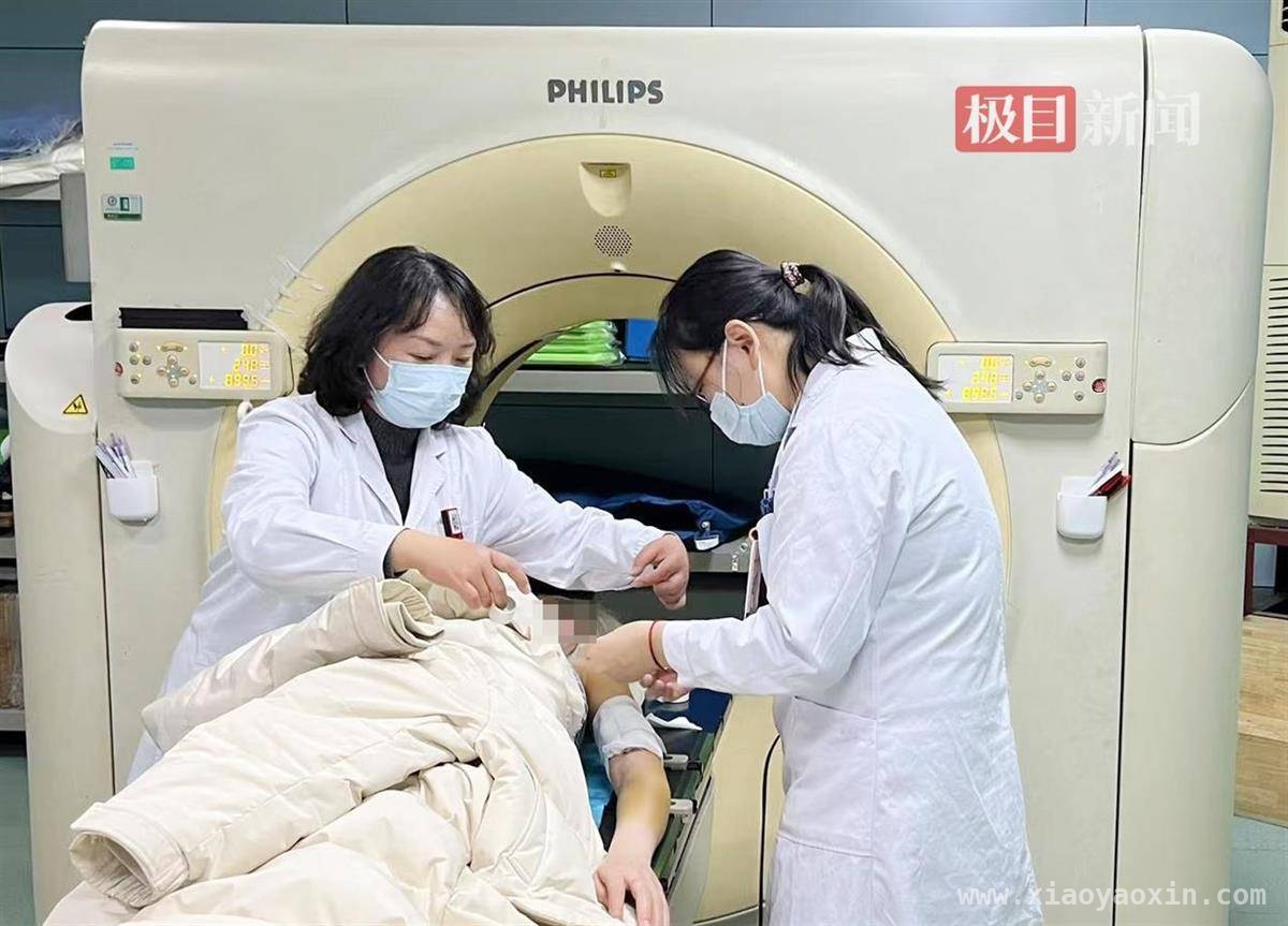 瘢痕体质女孩遇难题，手术放疗结合摆脱“蜈蚣疤”阴影