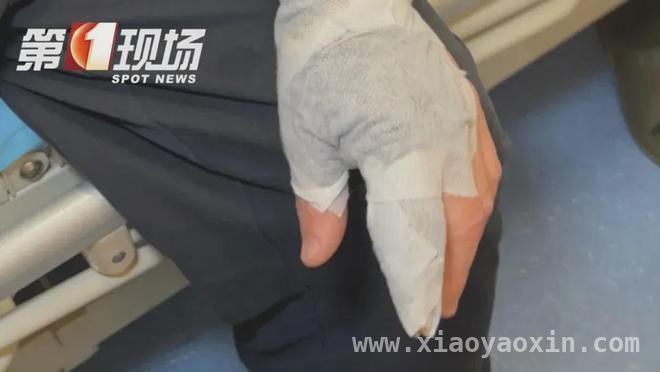 从刘先生的遭遇看海鲜处理中的“隐形杀手”，处理海鲜需谨慎，创伤弧菌危害大！