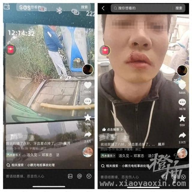 小鹏车主被充电枪“打脸”，公共充电枪重成隐患？，充电枪又重又危险，新能源车充电难题何去何从？