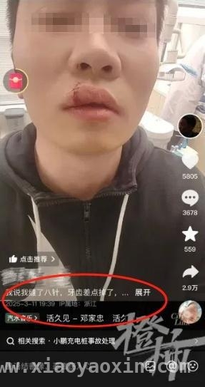 小鹏车主被充电枪“打脸”，公共充电枪重成隐患？，充电枪又重又危险，新能源车充电难题何去何从？