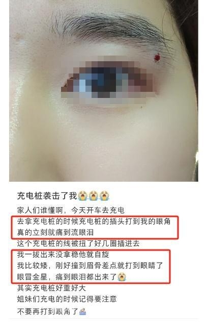 小鹏车主被充电枪“打脸”，公共充电枪重成隐患？，充电枪又重又危险，新能源车充电难题何去何从？