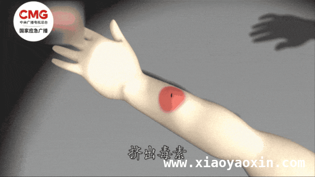 春日户外游，掌握防蜂和急救知识，远离蜂蜇危险