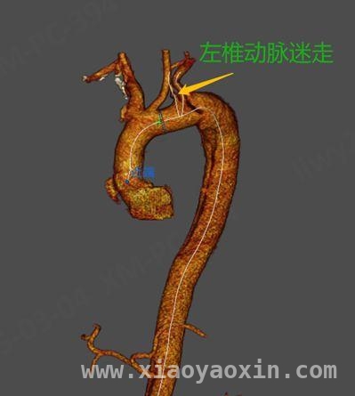 援疆情深，上海专家助力喀什医疗救治民警患者，跨越山海的救助：上海援疆团队成功救治叶城民警