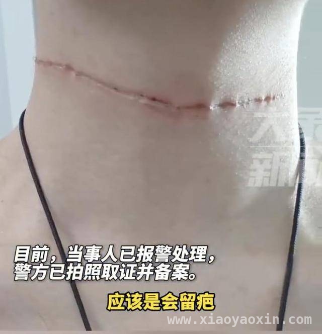柔软风筝线竟成伤人利刃，多起悲剧为你敲响安全警钟！ 骑行途中频发割伤事故，风筝线“隐形杀手”有多可怕？