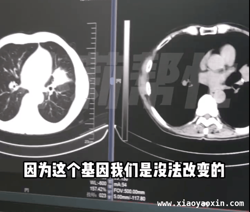 家族9口患癌8人离世，癌症阴影下的健康警钟 男子家族9口患癌8人离世，这些防癌方法你知道吗？