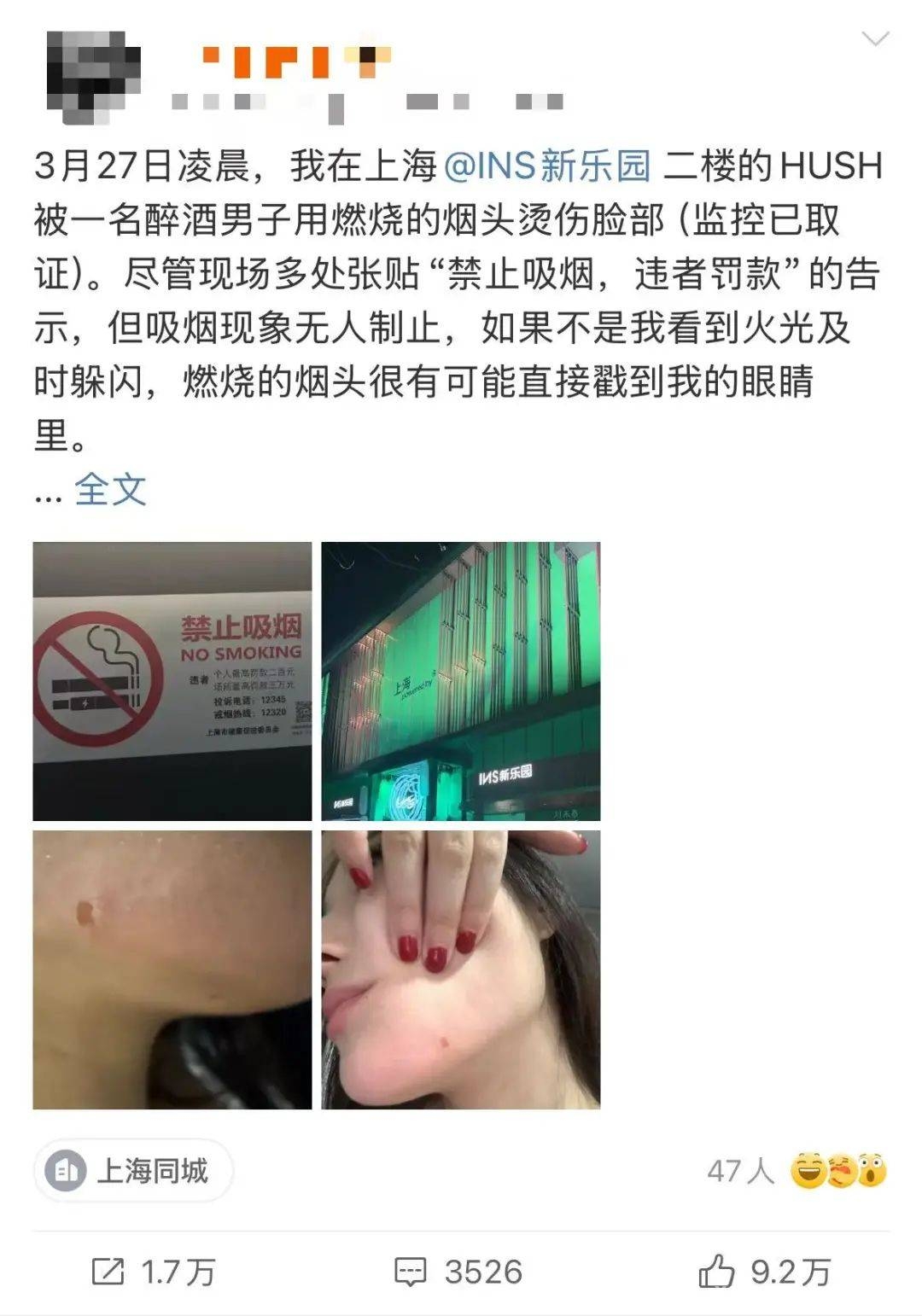 上海INS新乐园：烟头烫伤之痛与吸烟管理难题