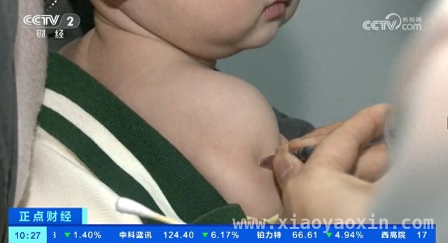 春季手足口病来袭，专家教你如何应对