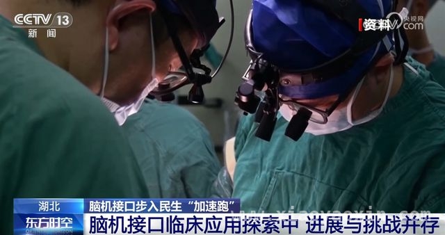 脑机接口：从科幻到现实，湖北率先开启医疗定价 湖北脑机接口医疗定价，为医学变革注入新动力