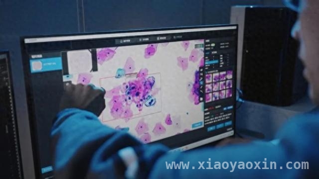 西湖大学多模态病理大模型：减轻医生负担的“超级助手”