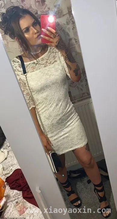 截肢悲剧后，她竟收获了世间最美好的爱情，英国妹子截肢之痛，换来一生挚爱与公道