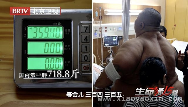 700斤“中国第一胖”跨700公里求医，成功减重开启新生活