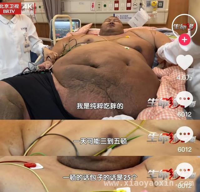 “中国第一胖”逆袭记：科学减重，重获健康人生，718.8斤“中国第一胖”逆袭，减重300斤开启新生活！