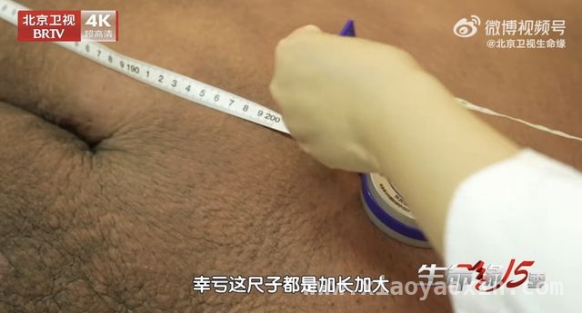 “中国第一胖”逆袭记：科学减重，重获健康人生，718.8斤“中国第一胖”逆袭，减重300斤开启新生活！